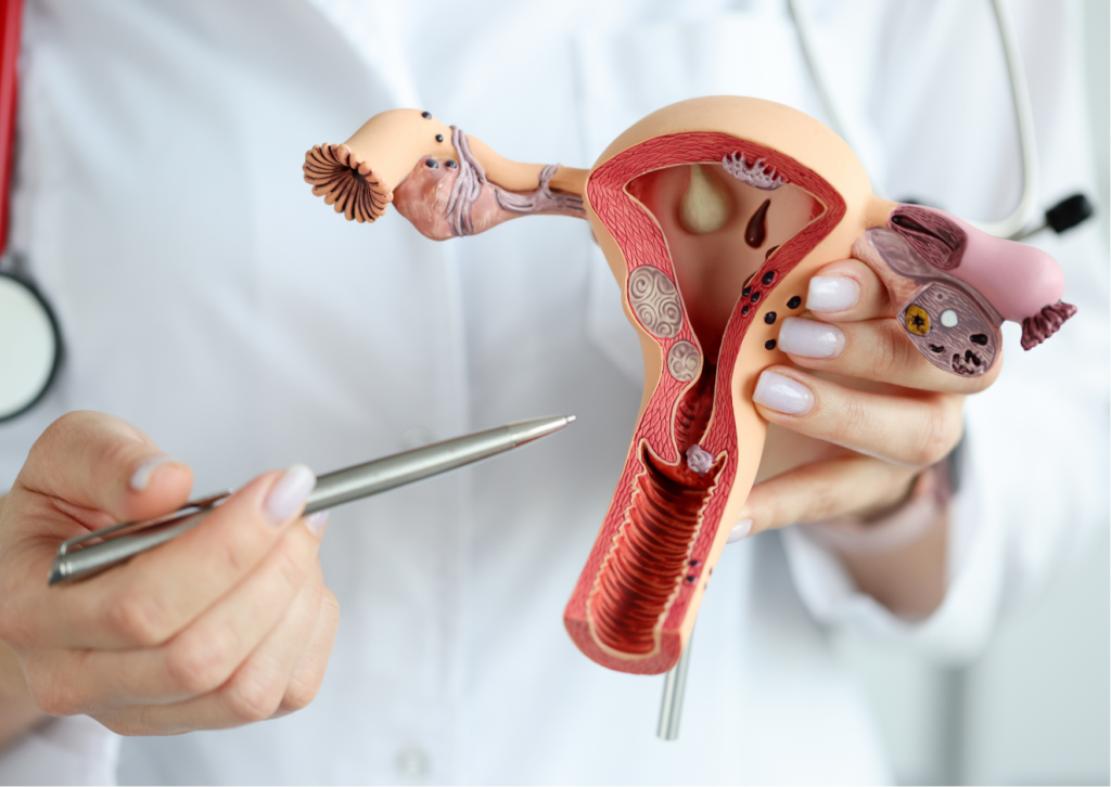 Vagina-Estudio vaginosis Pamplona