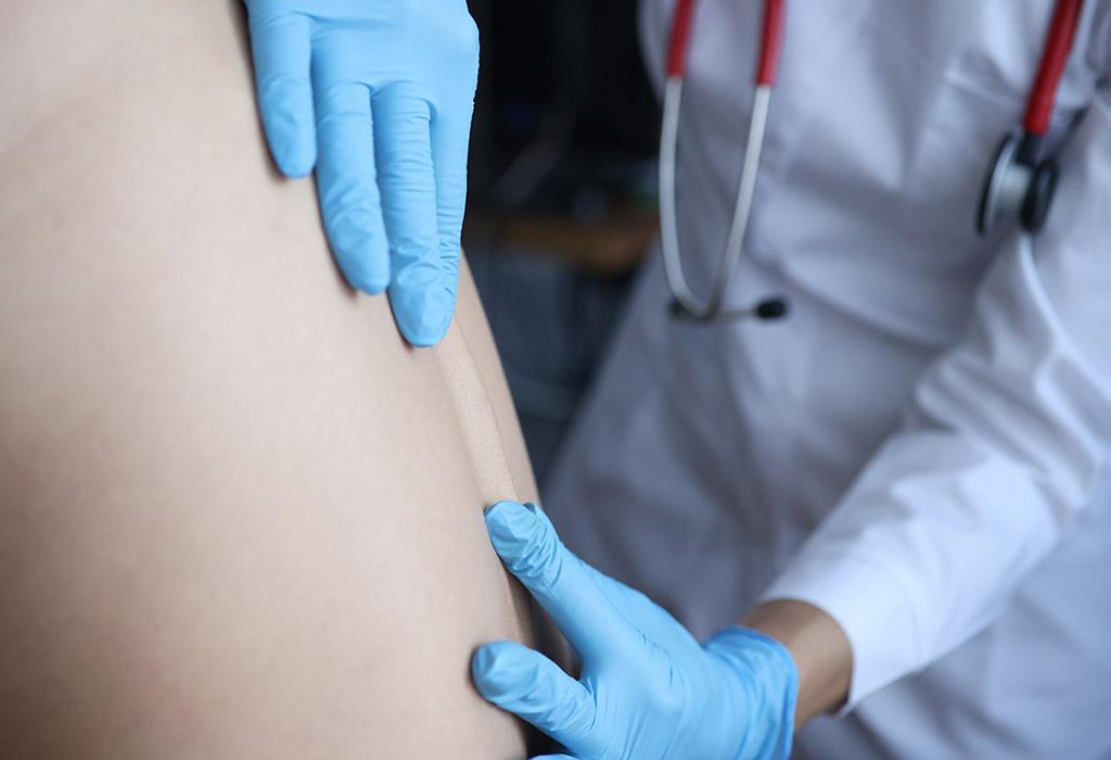 prevenir hernia discal en Pamplona